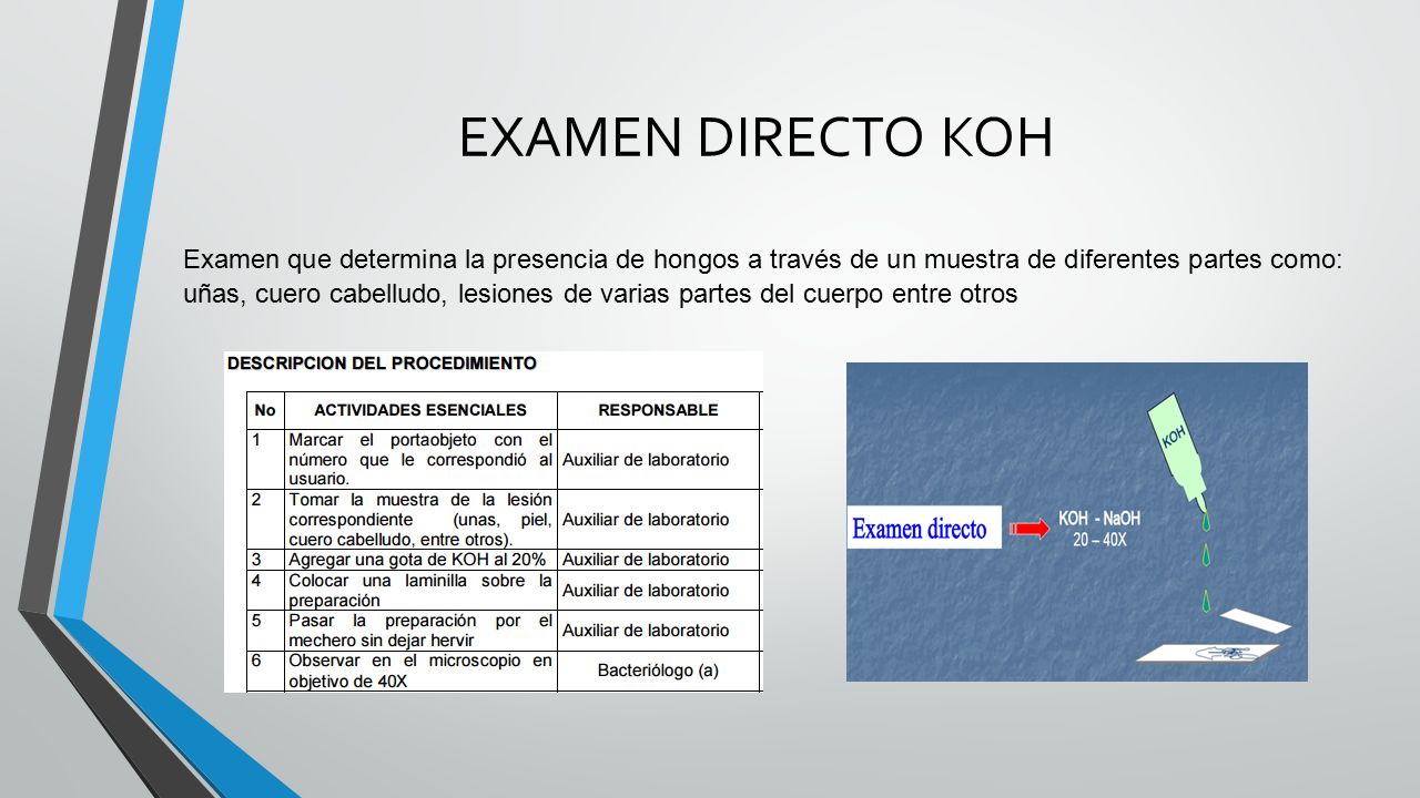 Las manifestaciones neurológicas de la osteocondrosis lumbar